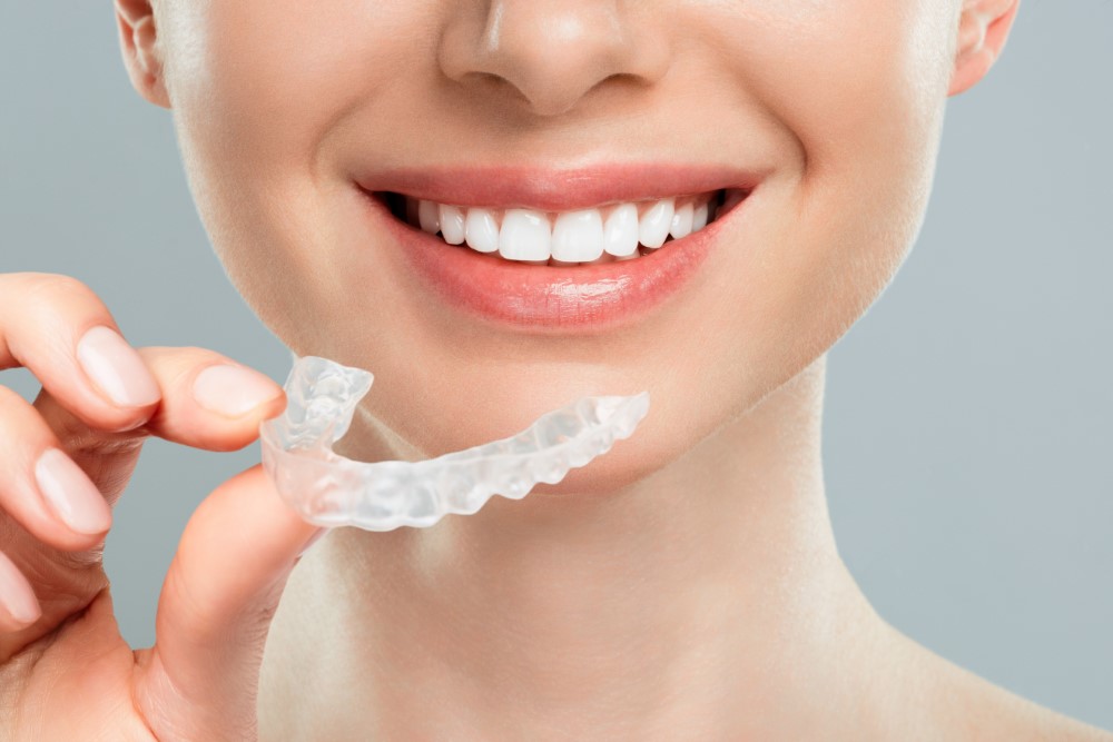 What Happens After Invisalign Treatment? - Thurman Orthodontics